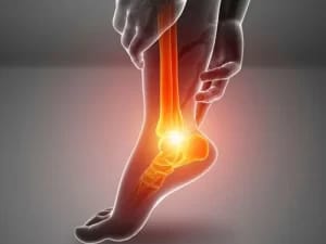 Ankle Pain or Sprain